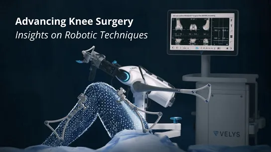 Robotic Knee Replacement